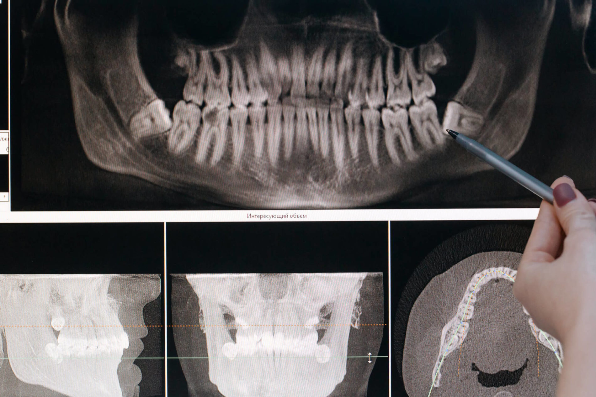 Mund- Kiefer Gesichtschirurgie Untersuchungsbild